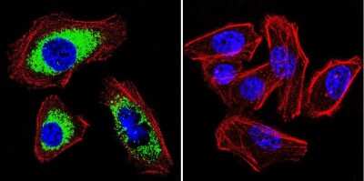 Immunocytochemistry/ Immunofluorescence: SERCA2 ATPase Antibody (2A7-A1) [NB300-581]