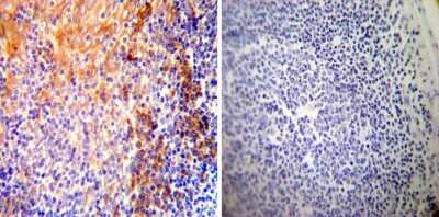 Immunohistochemistry-Paraffin: SERCA2 ATPase Antibody (2A7-A1) [NB300-581]