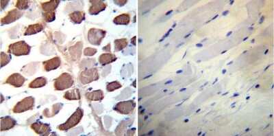 Immunohistochemistry-Paraffin: SERCA2 ATPase Antibody (2A7-A1) [NB300-581]