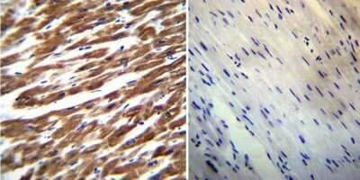 Immunohistochemistry-Paraffin: SERCA2 ATPase Antibody (IID8) - BSA Free [NB300-529]