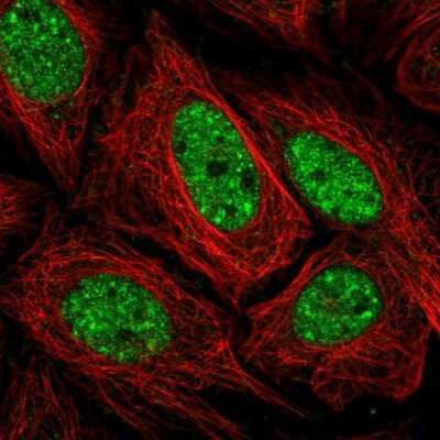 Immunocytochemistry/ Immunofluorescence: SERCA2 ATPase Antibody [NBP2-34147]