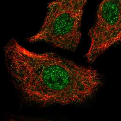 Immunocytochemistry/ Immunofluorescence: SERCA2 ATPase Antibody [NBP2-57446]