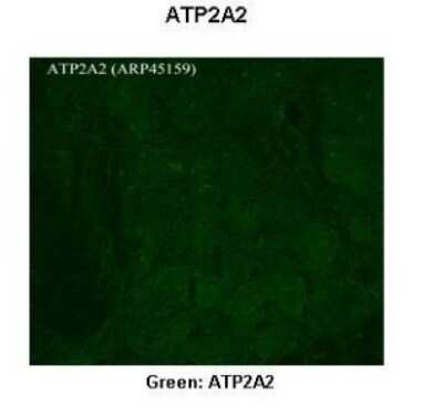 Immunohistochemistry: SERCA2 ATPase Antibody [NBP1-59203]