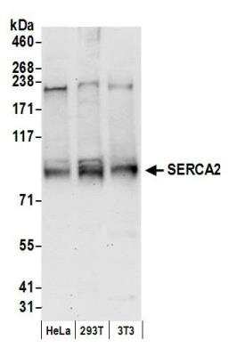 Western Blot: SERCA2 ATPase Antibody [NB100-237]