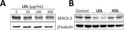 Western Blot: SERCA2 ATPase Antibody [NB100-237]