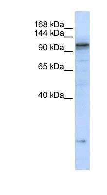 Western Blot: SERCA2 ATPase Antibody [NBP1-59203]