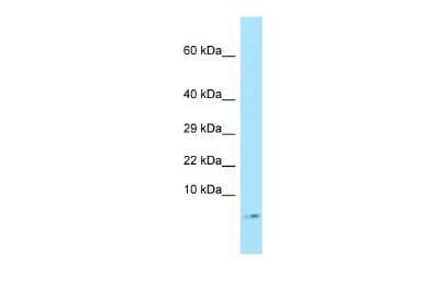 Western Blot: SERF1A Antibody [NBP2-88241]