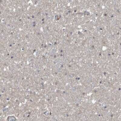 Immunohistochemistry-Paraffin: SERINC2 Antibody [NBP1-87927]