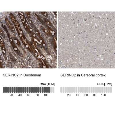Immunohistochemistry-Paraffin: SERINC2 Antibody [NBP1-87927]