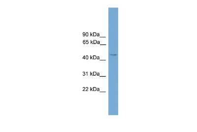 Western Blot: SERINC2 Antibody [NBP2-85708]