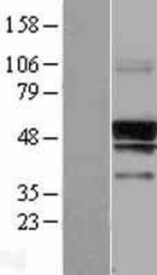 Western Blot: SERINC3 Overexpression Lysate [NBL1-15829]