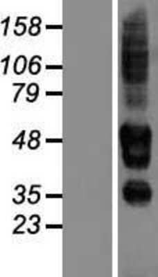 Western Blot: SERINC3 Overexpression Lysate [NBP2-04642]