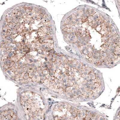 Immunohistochemistry-Paraffin: SERINC5 Antibody [NBP2-38369]