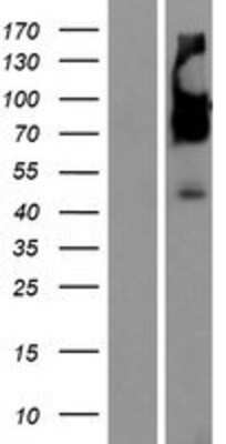 Western Blot: SERINC5 Overexpression Lysate [NBP2-10254]