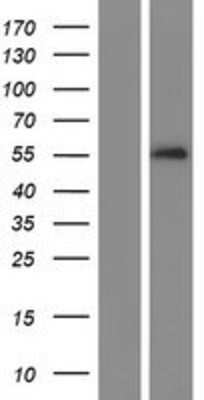 Western Blot: Serpin A10/ZPI Overexpression Lysate [NBP2-08261]
