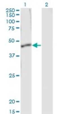 Western Blot: SERPINB1 Antibody (4A7) [H00001992-M01]