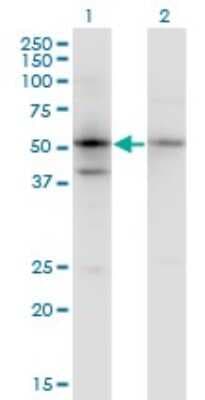 Western Blot: SERPINB1 Antibody (4D7) [H00001992-M02]