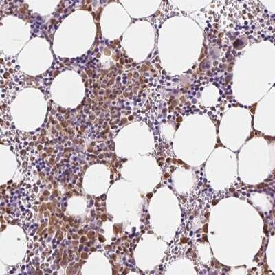 Immunohistochemistry: SERPINB1 Antibody [NBP2-49056]