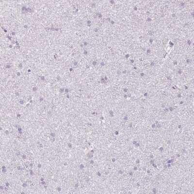 Immunohistochemistry-Paraffin: SERPINB1 Antibody [NBP2-49056]