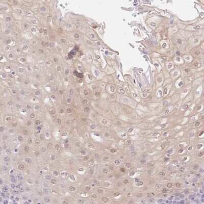 Immunohistochemistry-Paraffin: SERPINB1 Antibody [NBP2-49056]