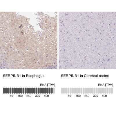 Immunohistochemistry-Paraffin: SERPINB1 Antibody [NBP2-49056]