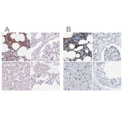 Immunohistochemistry-Paraffin: SERPINB1 Antibody [NBP2-49056]