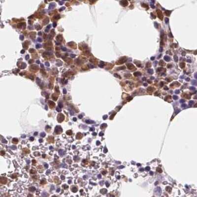 Immunohistochemistry-Paraffin: SERPINB1 Antibody [NBP2-49056]
