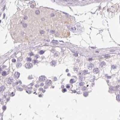 Immunohistochemistry-Paraffin: SERPINB1 Antibody [NBP2-49056]
