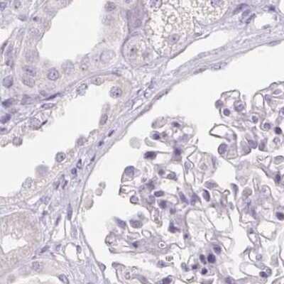 Immunohistochemistry-Paraffin: SERPINB1 Antibody [NBP2-49056]