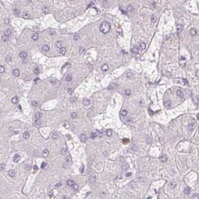 Immunohistochemistry-Paraffin: SERPINB1 Antibody [NBP2-49056]