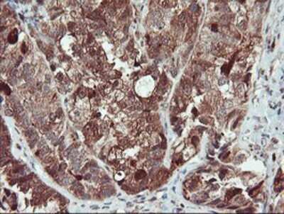 Immunohistochemistry: SERPINB1 Antibody (OTI3B4) - Azide and BSA Free [NBP2-74123]