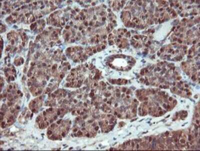 Immunohistochemistry: SERPINB1 Antibody (OTI3B4) - Azide and BSA Free [NBP2-74123]