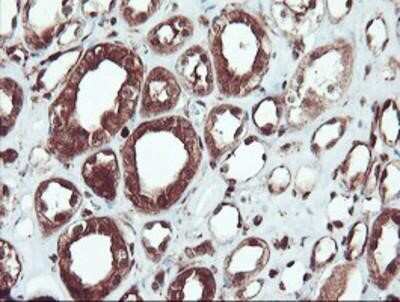 Immunohistochemistry-Paraffin: SERPINB1 Antibody (OTI3B4) [NBP2-03828]