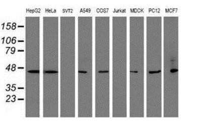 Western Blot: SERPINB1 Antibody (OTI3B4) [NBP2-03828]