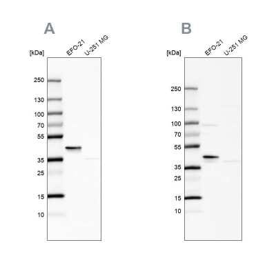 Western Blot: SERPINB1 Antibody [NBP1-89072]
