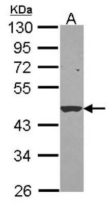 Western Blot: SERPINB1 Antibody [NBP2-20309]
