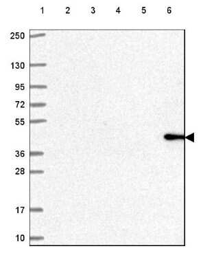 Western Blot: SERPINB1 Antibody [NBP2-49056]