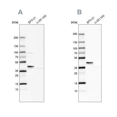 Western Blot: SERPINB1 Antibody [NBP2-49056]