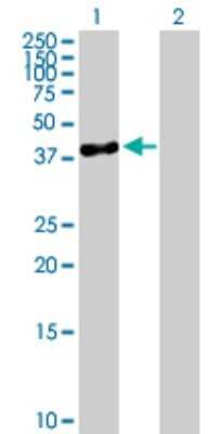 Western Blot: SERPINB10 Antibody [H00005273-B01P]