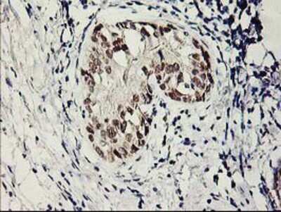 Immunohistochemistry-Paraffin: SERPINB13 Antibody (OTI2B6) [NBP2-01312]