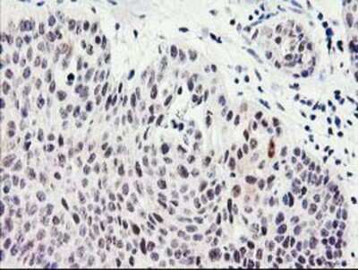 Immunohistochemistry-Paraffin: SERPINB13 Antibody (OTI2B6) [NBP2-01312]