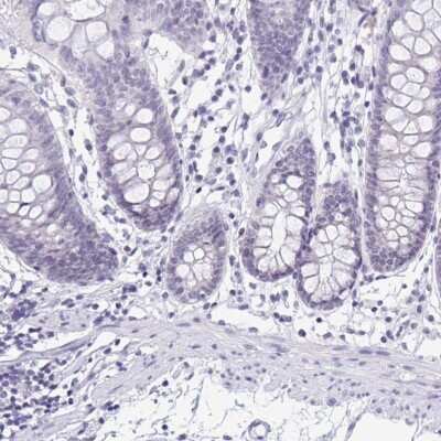 Immunohistochemistry-Paraffin: SERPINB13 Antibody [NBP2-38821]