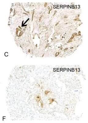 Immunohistochemistry: SERPINB13 Antibody (OTI2B6) - Azide and BSA Free [NBP2-74126]