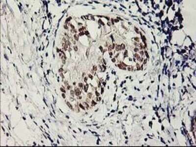 Immunohistochemistry: SERPINB13 Antibody (OTI2B6) - Azide and BSA Free [NBP2-74126]