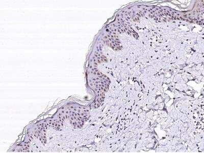 Immunohistochemistry-Paraffin: SERPINB4 Antibody (001) [NBP2-90154]