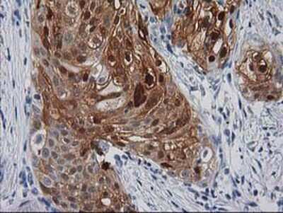 Immunohistochemistry-Paraffin: SERPINB4 Antibody (OTI4C8) [NBP2-03595]