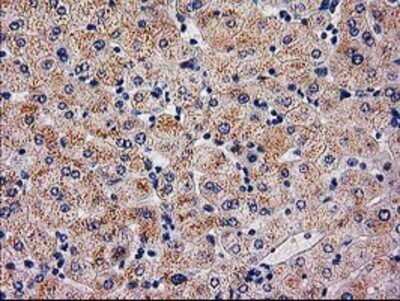 Immunohistochemistry: SERPINB4 Antibody (OTI4C8) - Azide and BSA Free [NBP2-74141]