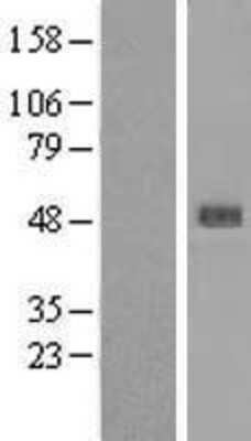Western Blot: SERPINB4 Overexpression Lysate [NBL1-15847]