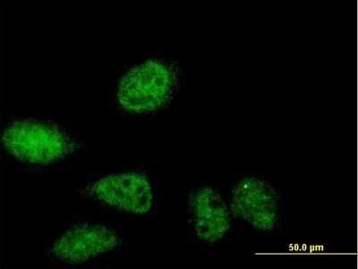Immunocytochemistry/ Immunofluorescence: SERTAD2 Antibody [H00009792-B01P]