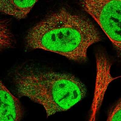 Immunocytochemistry/ Immunofluorescence: SERTAD2 Antibody [NBP1-81541]